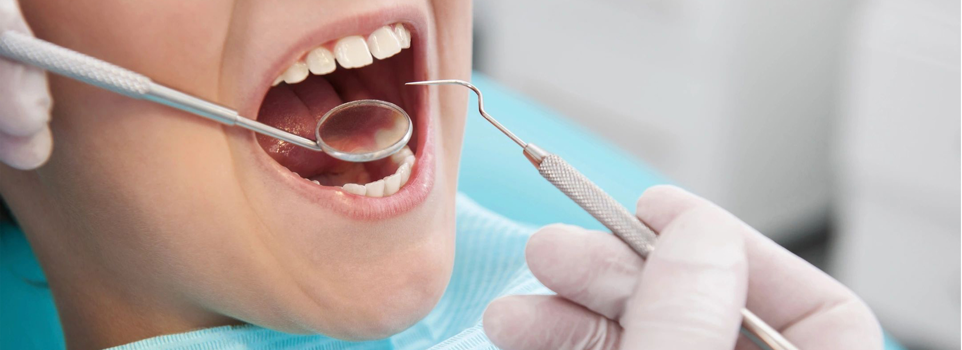 Professional Dental Cleaning (Scaling)